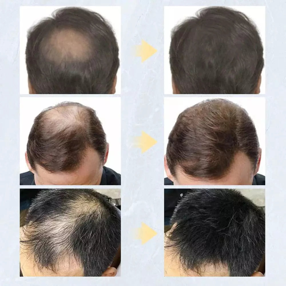 Toppik Toppik Hair Toppik Hair Fiber Fibra Capilar