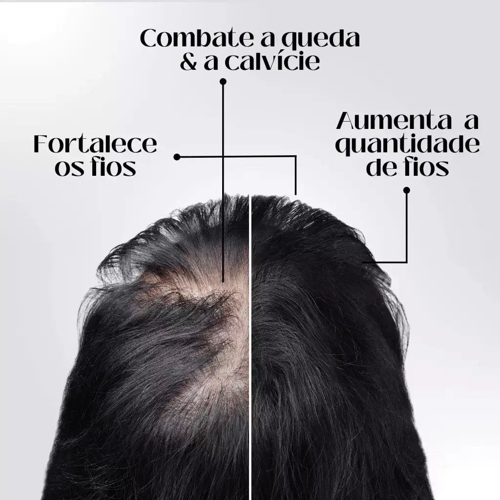 Repair Hair Regrowth