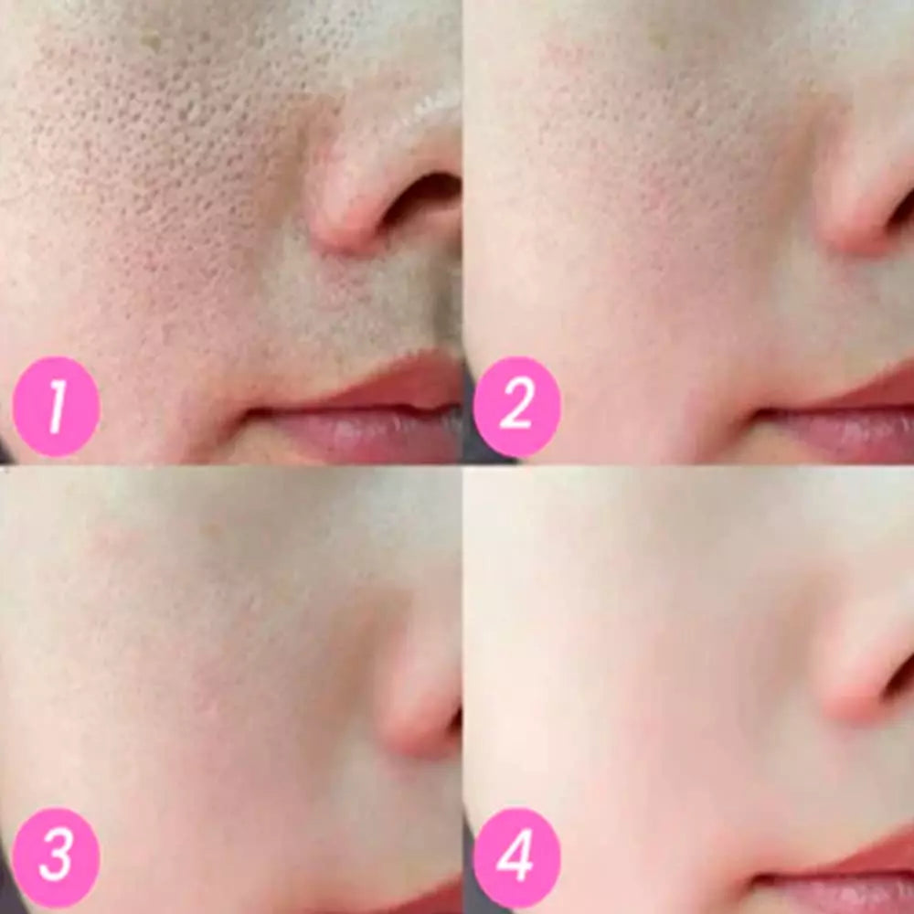 Creme Mágico FaceSlift - Esconde Imperfeições, Remove Manchas e Rugas