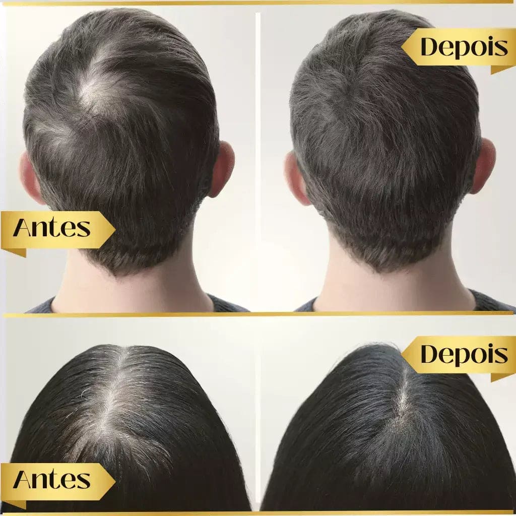 Repair Hair Regrowth
